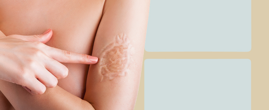 Imagem Correção de Cicatriz