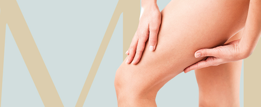 Imagem Lifting de coxa