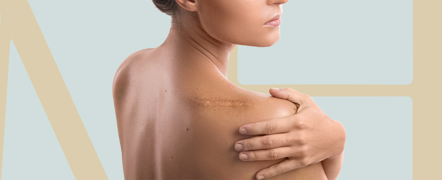 Imagem Cirurgias Reconstrutoras